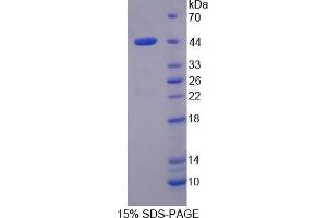Image no. 1 for Calpain 10 (CAPN10) (AA 22-374) protein (His tag) (ABIN6237397)