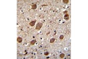 Immunohistochemistry analysis in formalin fixed and paraffin embedded human brain tissue reacted with KCTD8 Antibody (C-term) followed which was peroxidase conjugated to the secondary antibody and followed by DAB staining. (KCTD8 anticorps  (C-Term))