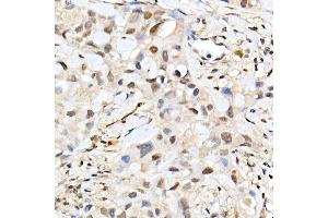 Immunohistochemistry of paraffin-embedded Human tonsil (negative control sample) using α-Smooth Muscle Actin  Rabbit pAb (ABIN6127402, ABIN6136473, ABIN6136476 and ABIN6214239) at dilution of 1:25 (40x lens).