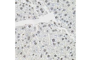 Immunohistochemistry of paraffin-embedded mouse liver using TCEB1 antibody (ABIN6131624, ABIN6148930, ABIN6148932 and ABIN6219151) (40x lens). (TCEB1 anticorps  (AA 1-112))