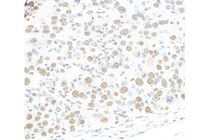 Immunohistochemistry (IHC) image for anti-RNA-binding protein Raly (RALY) (AA 256-306) antibody (ABIN7454547) (Raly anticorps  (AA 256-306))