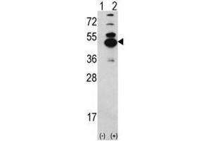 Image no. 1 for anti-Calcium/calmodulin-Dependent Protein Kinase ID (CAMK1D) (N-Term) antibody (ABIN452804) (CAMK1D anticorps  (N-Term))