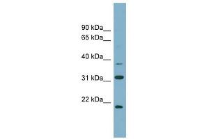 N6AMT1 antibody used at 1 ug/ml to detect target protein. (N6AMT1 anticorps)