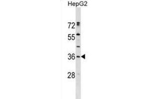Western Blotting (WB) image for anti-Endoplasmic Reticulum Protein 27 (ERP27) antibody (ABIN2999524) (ERP27 anticorps)