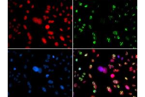 Immunofluorescence analysis of GFP-RNF168 transgenic U2OS cells using RAG2 antibody.