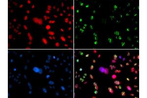 Immunofluorescence analysis of GFP-RNF168 transgenic U2OS cells using RAG2 antibody. (RAG2 anticorps  (AA 258-527))