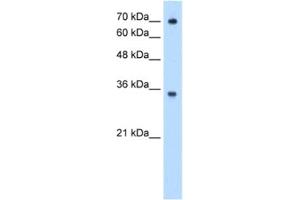 Western Blotting (WB) image for anti-IgG receptor FcRn (FcRn) antibody (ABIN2462979) (FcRn anticorps)