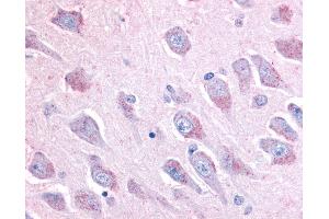 Anti-LINGO1 antibody IHC of human brain, hippocampus. (LINGO1 anticorps  (C-Term))