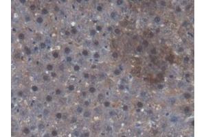 Detection of CAMK2a in Rat Liver Tissue using Polyclonal Antibody to Calcium/Calmodulin Dependent Protein Kinase II Alpha (CAMK2a)