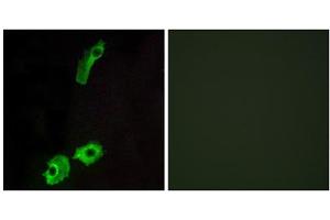 Immunofluorescence analysis of HeLa cells, using GPR151 antibody. (GPR151 anticorps  (C-Term))