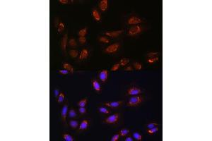 Immunofluorescence analysis of U-2 OS cells using RALGDS antibody (ABIN7269838) at dilution of 1:100. (RALGDS anticorps)