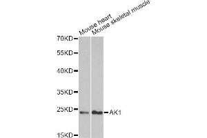 Western blot analysis of extracts of various cell lines, using AK1 antibody. (Adenylate Kinase 1 anticorps)