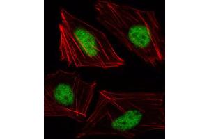 Immunofluorescence (IF) image for anti-T-Box 15 (TBX15) antibody (ABIN3000287)
