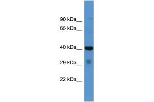 Host: Rabbit Target Name: SCAMP3 Sample Type: RPMI-8226 Whole cell lysates Antibody Dilution: 1. (SCAMP3 anticorps  (N-Term))