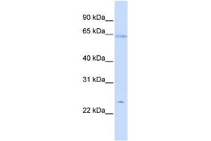 WB Suggested Anti-PRDX2 Antibody Titration:  0. (Peroxiredoxin 2 anticorps  (Middle Region))