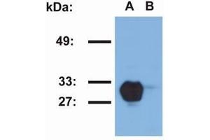 Western Blotting (WB) image for anti-Major Histocompatibility Complex, Class II, DR beta 1 (HLA-DRB1) antibody (ABIN238469) (HLA-DRB1 anticorps)
