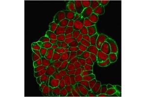 Immunofluorescent staining of PFA-fixed MCF-7 cells. (CD47 anticorps)