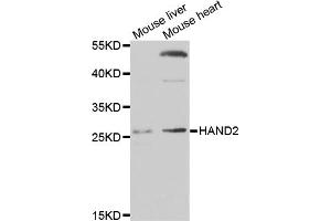 Western blot analysis of extracts of various cell lines, using HAND2 antibody (ABIN3214288) at 1/1000 dilution. (HAND2 anticorps)
