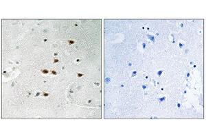 Immunohistochemistry (IHC) image for anti-Itchy E3 Ubiquitin Protein Ligase Homolog (ITCH) (pTyr420) antibody (ABIN1847708) (ITCH anticorps  (pTyr420))