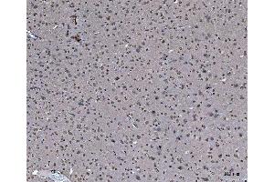 IHC analysis of hnRNP U/p120/HNRNPU using anti-hnRNP U/p120/HNRNPU antibody (ABIN7600979).