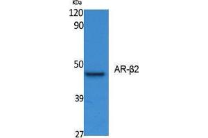 Western Blotting (WB) image for anti-Androgen Receptor beta 2 (Ser127) antibody (ABIN3187616) (Androgen Receptor beta 2 anticorps  (Ser127))