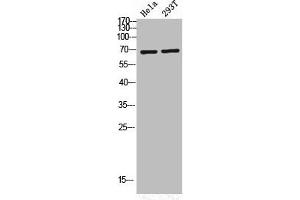 Western Blot analysis of HELA 293T cells using Phospho-PKC ζ (T560) Polyclonal Antibody (PKC zeta anticorps  (pThr560))