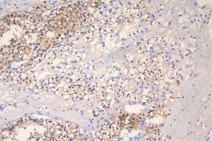 IHC analysis of FHL using anti-FHL antibody (ABIN7600488). (FHL1 anticorps  (AA 2-323))