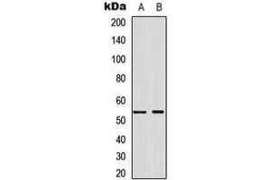 Western blot analysis of Annexin A7 expression in A549 (A), NS-1 (B) whole cell lysates. (Annexin VII anticorps  (Center))