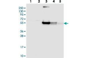 Western blot analysis of Lane 1: RT-4, Lane 2: U-251 MG, Lane 3: Human Plasma, Lane 4: Liver, Lane 5: Tonsil with RINL polyclonal antibody .