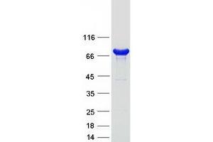 Validation with Western Blot