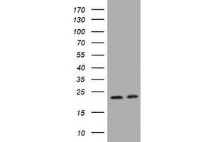 Image no. 1 for anti-GTPase Kras (KRAS) antibody (ABIN1499069)