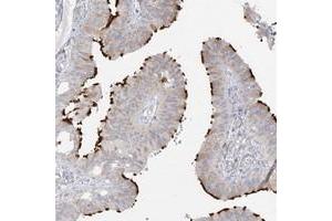 Immunohistochemical staining of human fallopian tube with LBA1 polyclonal antibody  shows distinct positivity in cilia of glandular cells. (LBA1 anticorps)