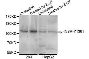 Western blot analysis of extracts of various cell lines, using Phospho-INSR-Y1361 antibody (ABIN5969899). (ISR-beta anticorps  (pTyr1361, Tyr1361))