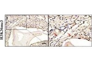 Regenerative potential and expression of hnRNPL, Setd2 and H3K36me3 in the healing of bone defects filled with MBG and Sr-MBG.
