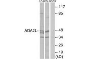 Western Blotting (WB) image for anti-Transcriptional Adaptor 2A (TADA2A) (AA 206-255) antibody (ABIN2889346) (TADA2L anticorps  (AA 206-255))