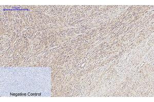 Immunohistochemical analysis of paraffin-embedded human uterus tissue. (MMP2 anticorps  (AA 580-660))