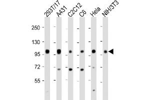 All lanes : Anti-IGF1 Receptor (IGF1R) Antibody (C-term) at 1:2000 dilution Lane 1: 293T/17 whole cell lysate Lane 2: A431 whole cell lysate Lane 3: C2C12 whole cell lysate Lane 4: C6 whole cell lysate Lane 5: Hela whole cell lysate Lane 6: NIH/3T3 whole cell lysate Lysates/proteins at 20 μg per lane.