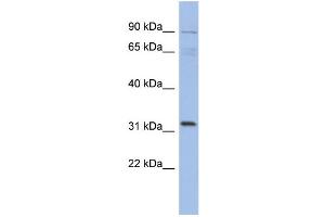 WB Suggested Anti-TBC1D14 Antibody Titration: 0. (TBC1D14 anticorps  (N-Term))
