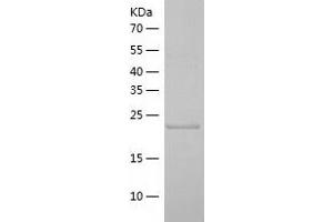 Western Blotting (WB) image for Zinc Finger, AN1-Type Domain 5 (ZFAND5) (AA 1-213) protein (His tag) (ABIN7125805)