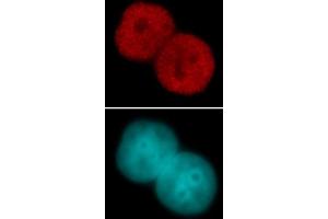 Histone H3 acetyl Lys23 pAb tested by immunofluorescence. (Histone 3 anticorps  (H3K23ac))