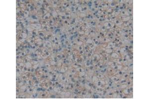 IHC-P analysis of Human Kidney, with DAB staining. (Renin anticorps  (AA 67-179))