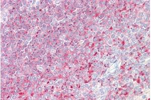 anti-Tumor Protein D52 (TPD52) (C-Term) antibody