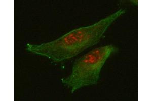IF analysis of RETREG1 using anti-RETREG1 antibody (ABIN7599962) and anti-Tubulin Alpha antibody (ABIN7600339). (FAM134B anticorps  (AA 131-446))