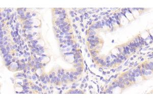 Detection of GOLPH2 in Human Small intestine Tissue using Polyclonal Antibody to Golgi Phosphoprotein 2 (GOLPH2)