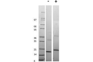 SDS-PAGE of Human Tumor Necrosis Factor Receptor Type 1 Recombinant Protein SDS-PAGE of Human Tumor Necrosis Factor Receptor Type 1 Recombinant Protein.