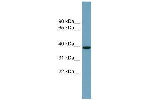 WB Suggested Anti-NUDCD3 Antibody Titration: 0.