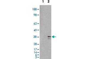 HEK293 overexpressing SIRT4 and probed with SIRT4 polyclonal antibody  (mock transfection in first lane), tested by Origene. (SIRT4 anticorps  (C-Term))