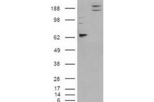 Western blot analysis of CADM1 on cells were transfected with the pCMV6-ENTRY control or pCMV6-ENTRY CADM1 cDNA using CADM1 polyclonal antibody . (CADM1 anticorps)