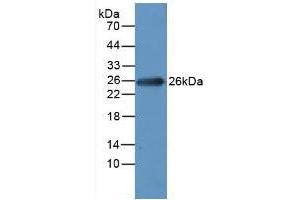 Figure. (MYL1 anticorps  (AA 3-142))
