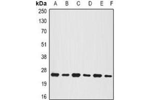 Western blot analysis of BNIP1 expression in MCF7 (A), Jurkat (B), mouse testis (C), mouse pancreas (D), rat brain (E), rat liver (F) whole cell lysates. (BNIP1 anticorps)